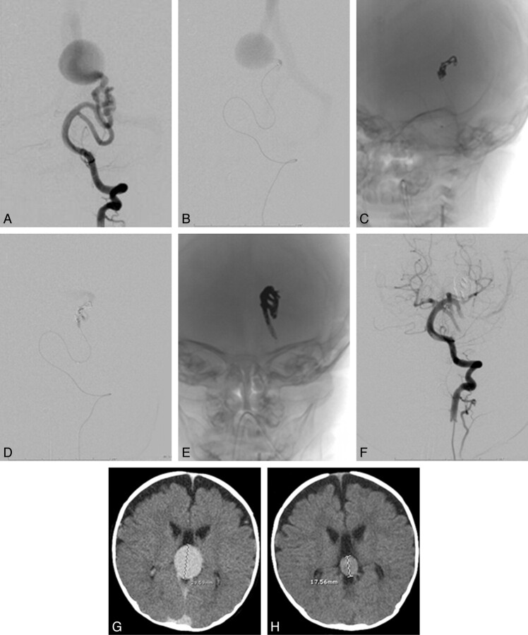 Fig 1.