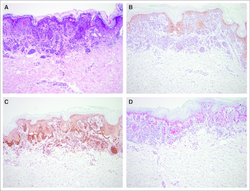 Fig 3.