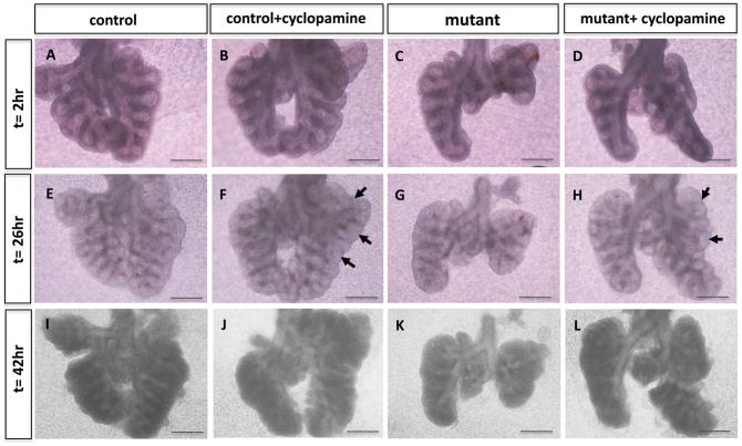 Fig. 12