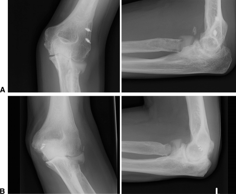 Fig. 3A–B