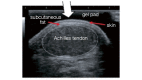 Supplementary Fig.5. Short-axis cross-sectional image