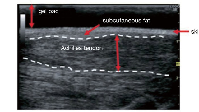 Supplementary Fig.6. Long-axis cross-sectional image