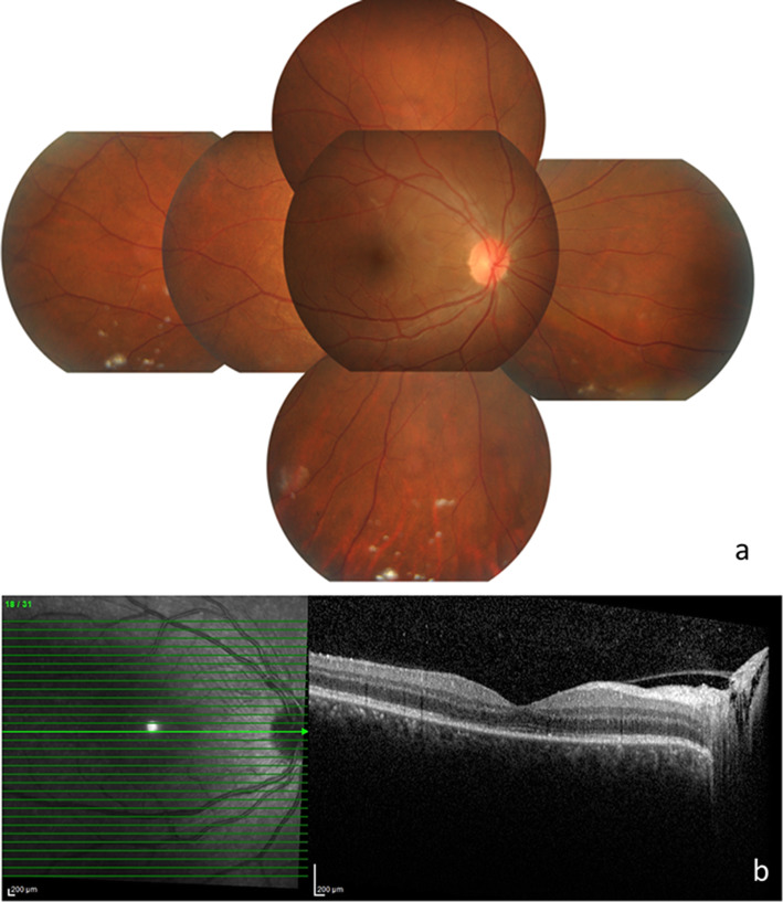 Fig. 2