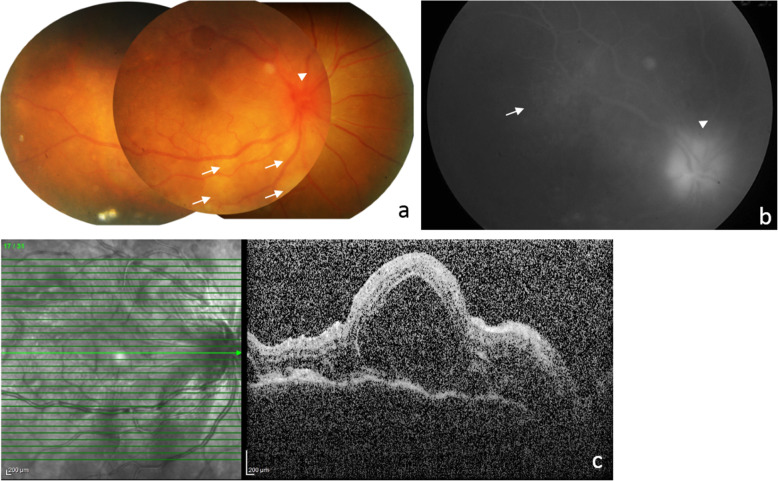 Fig. 1