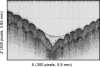 Fig. 18