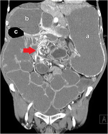 Fig. 2