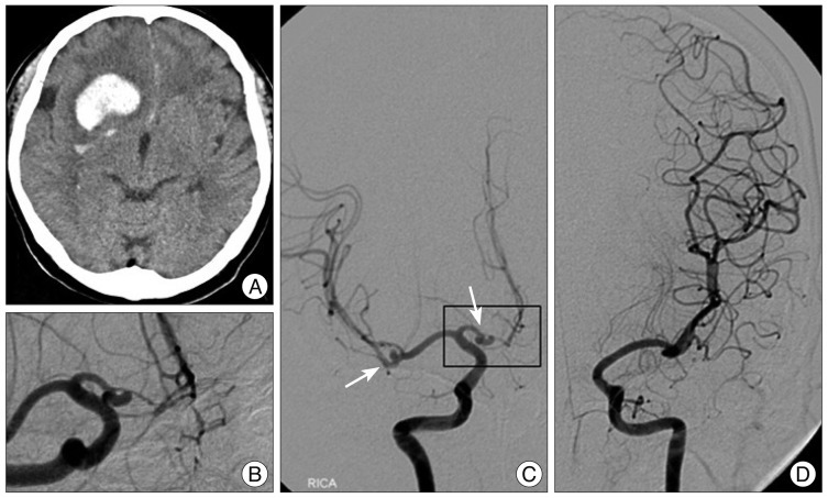 Fig. 1