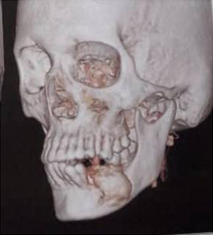 Fig. 3