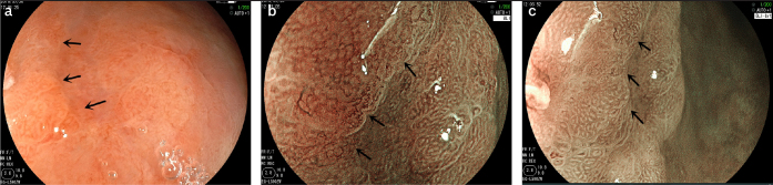 Figure 2. a–c