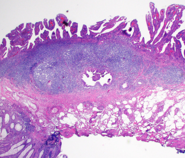 Figure 17