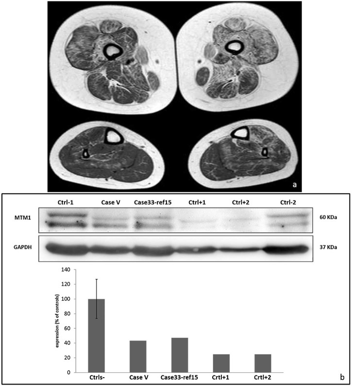 Fig. 2