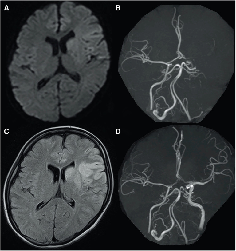 Fig. 3