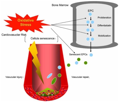 Fig. (2). Oxidative stresses on endothelial progenitor cells (EPCs) in cardiovascular diseases.