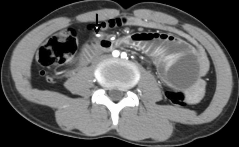 Fig. 9