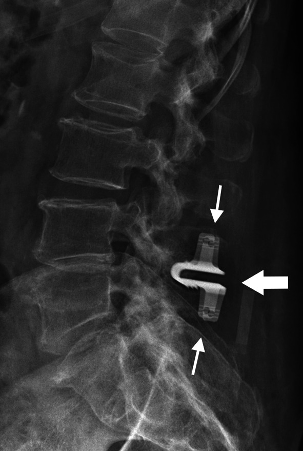 Fig. 11