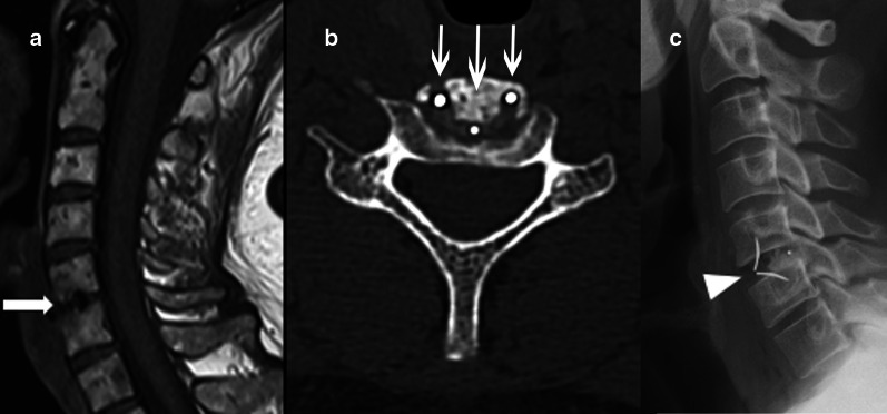 Fig. 9