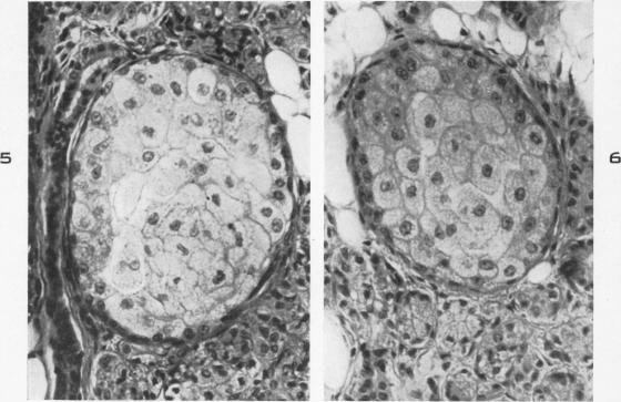 Fig. 5 and 6