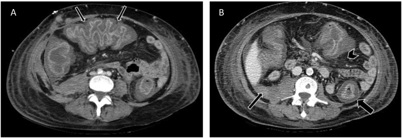 Fig. 1