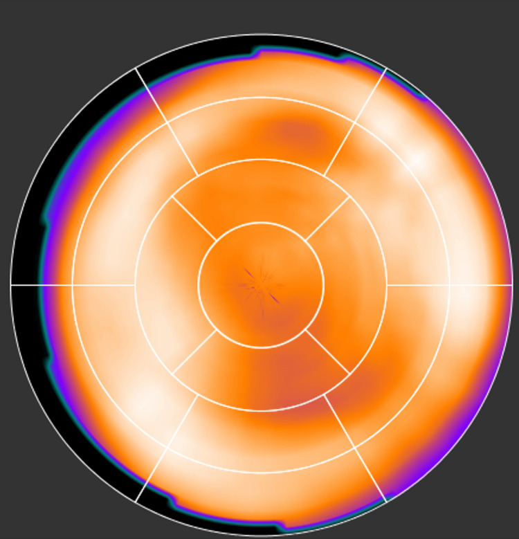 Figure 13