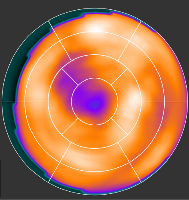 Figure 12