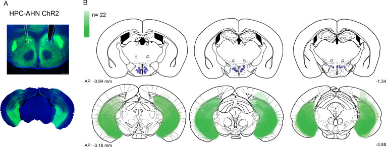 Figure 4—figure supplement 1.