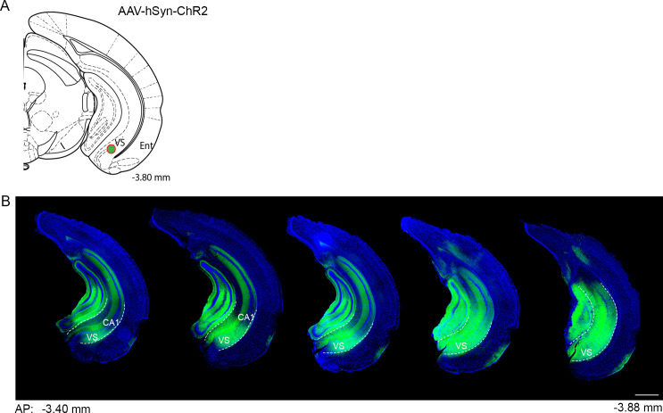 Figure 3—figure supplement 1.