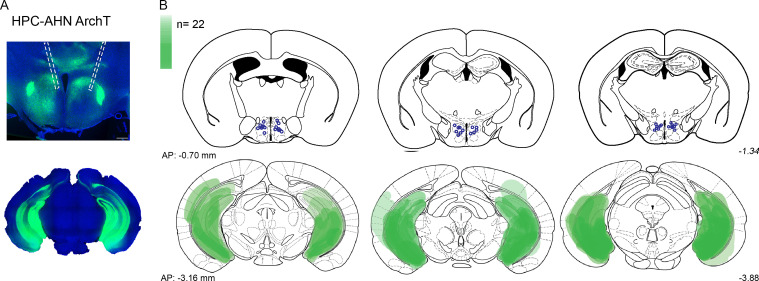 Figure 6—figure supplement 1.