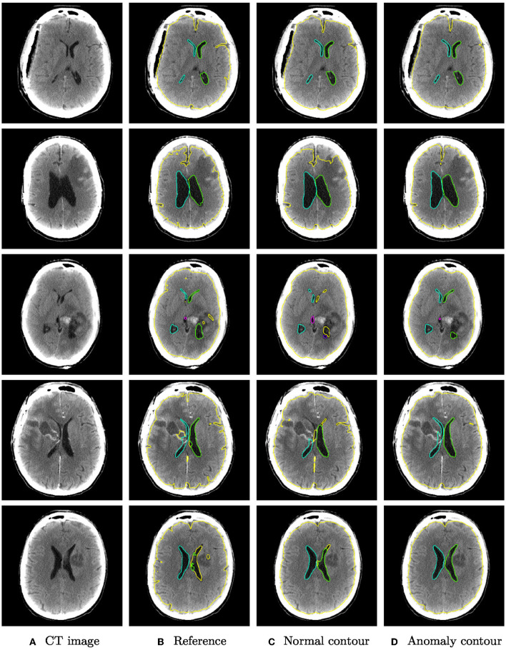 Figure 5