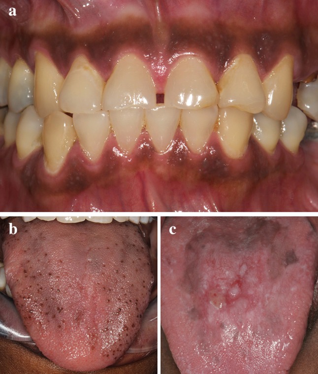 Fig. 1