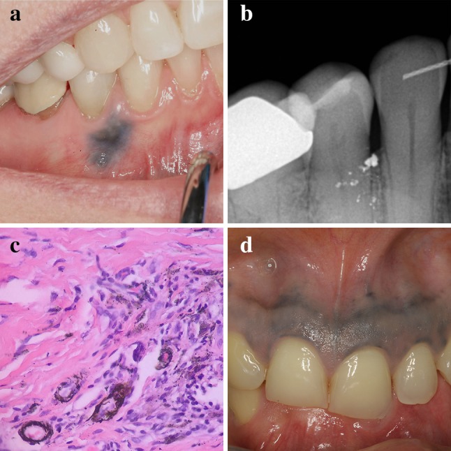 Fig. 9