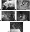 FIG. 1