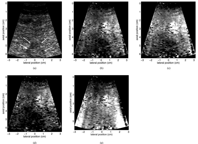 Fig. 13