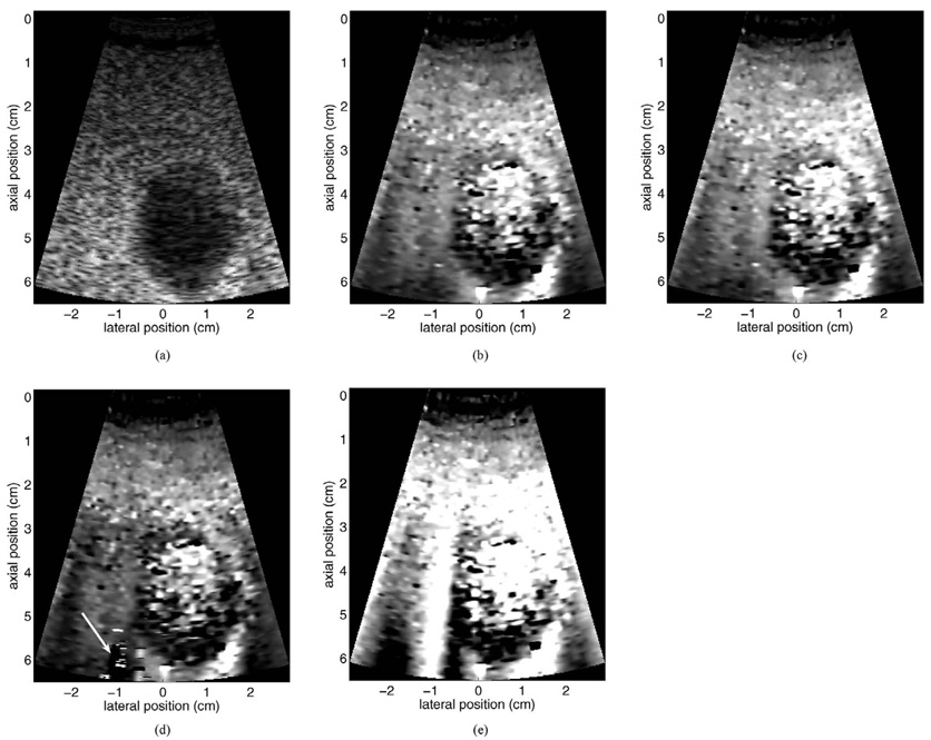 Fig. 12