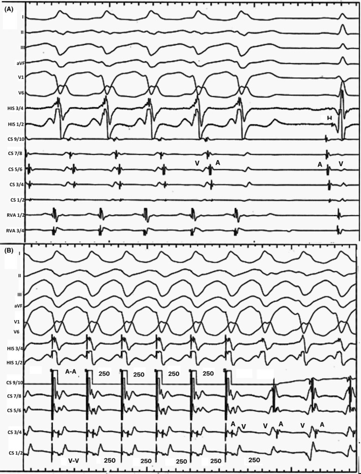 FIGURE 2