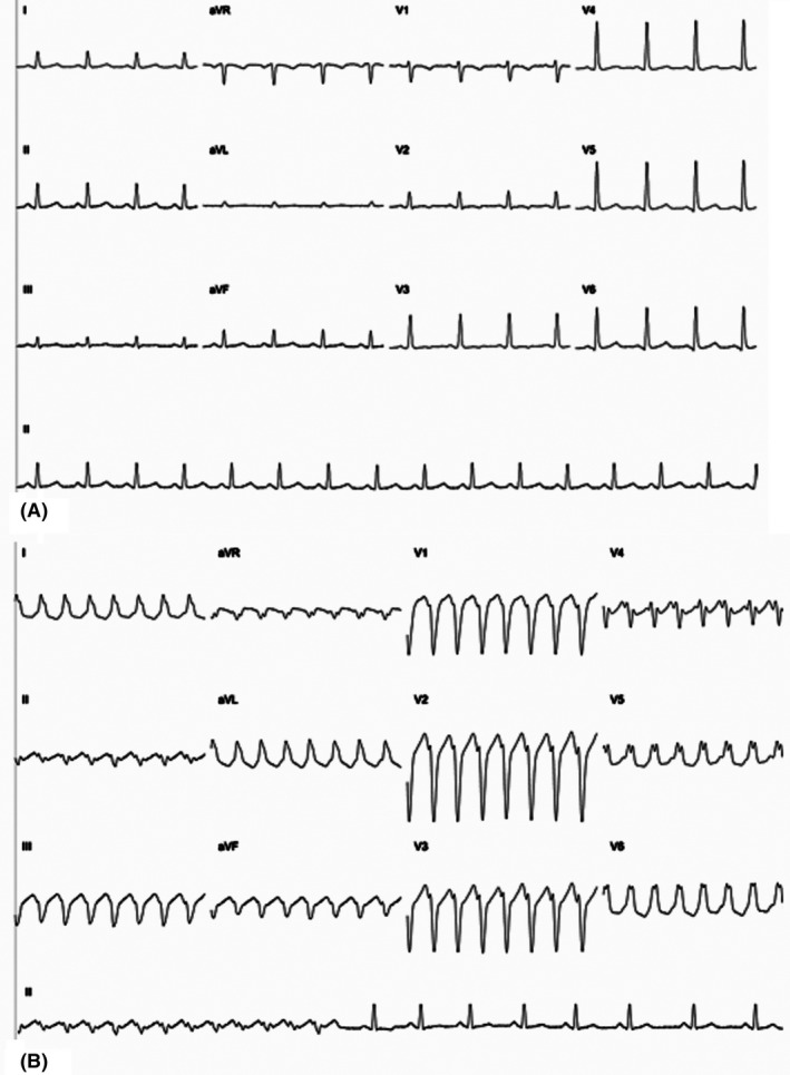 FIGURE 1