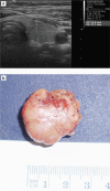 Fig 2.