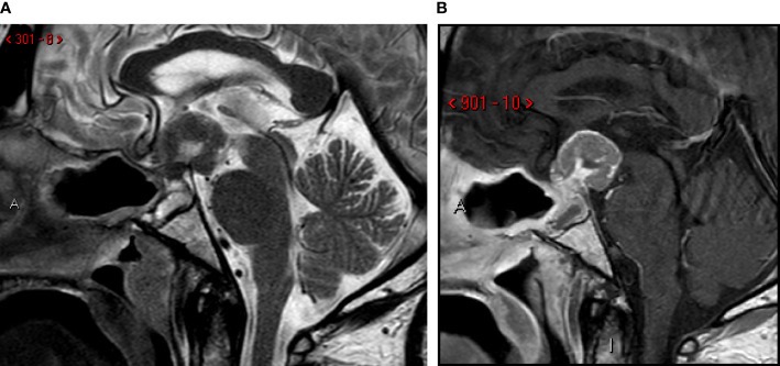 Figure 3