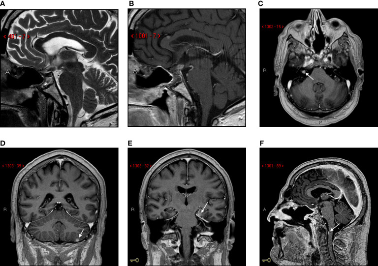 Figure 4