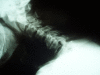 Fig. (2)