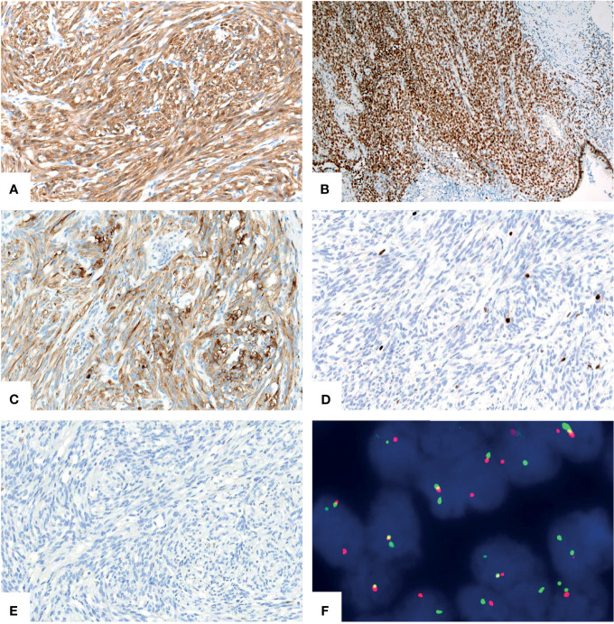 Figure 2