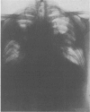 245