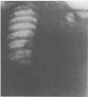 255