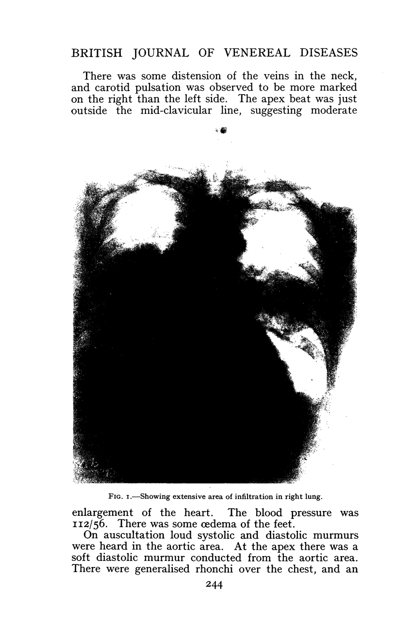 244