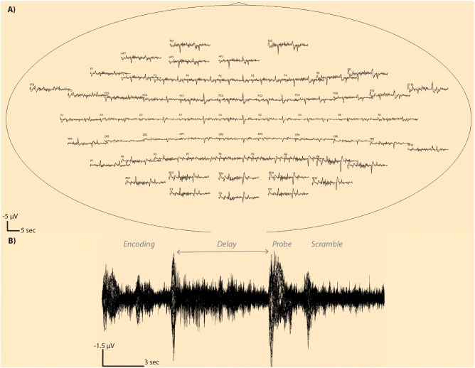 Fig 3