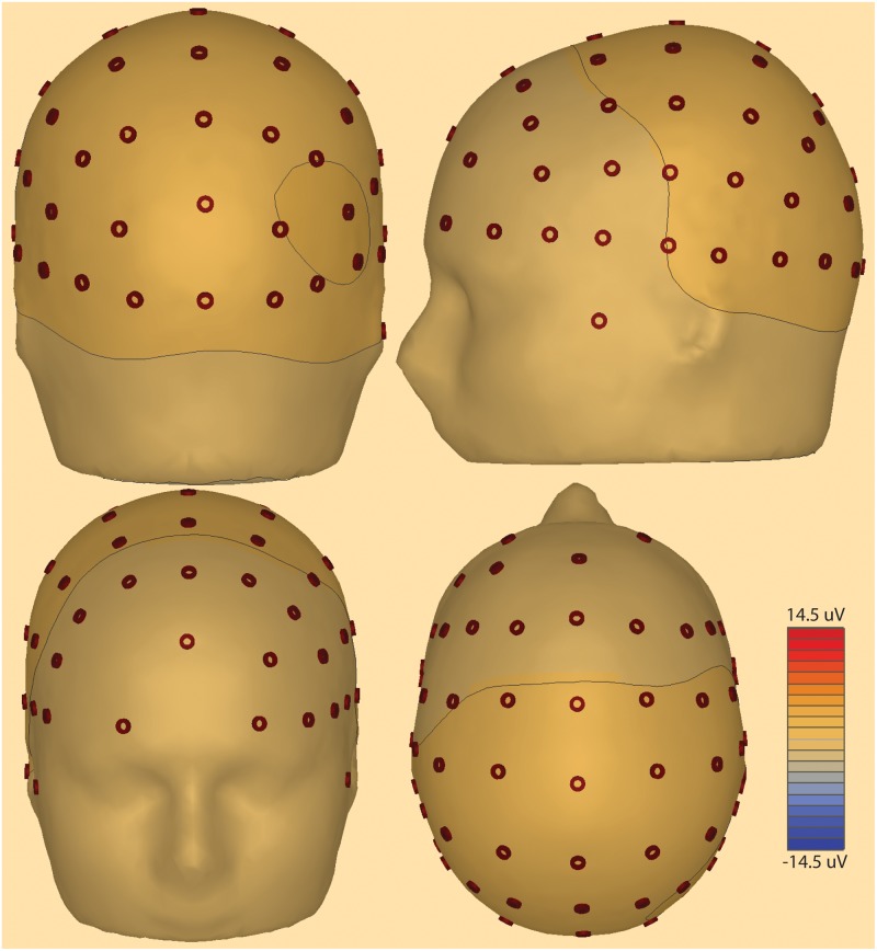 Fig 2