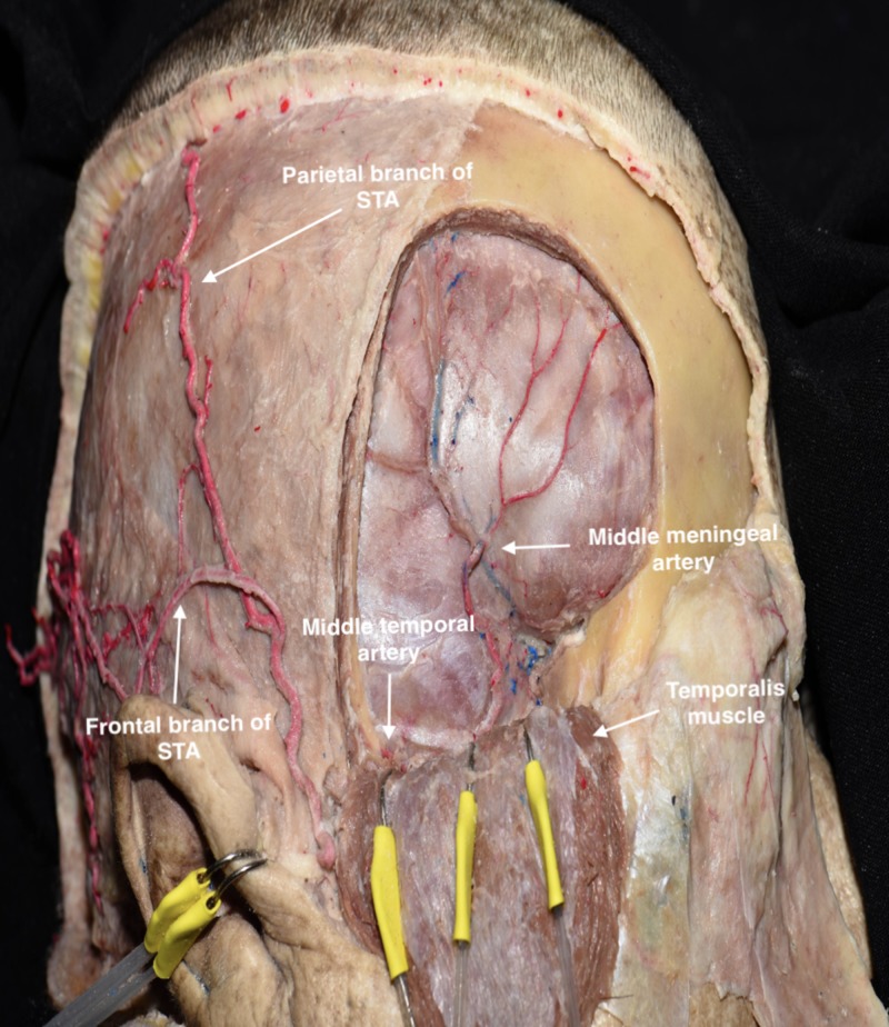 Figure 7