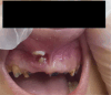 Fig. 10