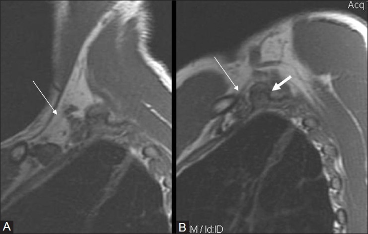 Figure 18(A, B)