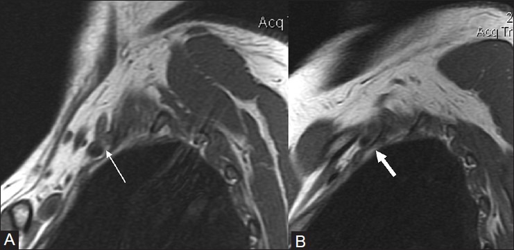 Figure 16(A, B)