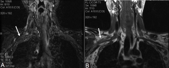 Figure 1(A, B)